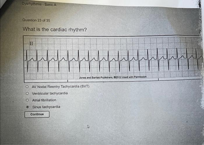 Relias dysrhythmia basic b 35 questions