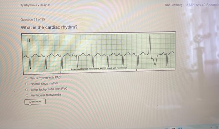 Relias dysrhythmia basic b 35 questions